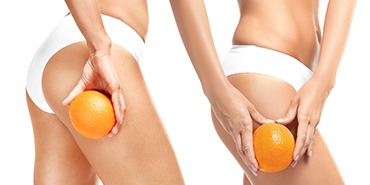 Dégommer la cellulite avec la technique du palper-rouler manuel